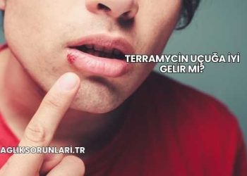 Terramycin Uçuğa İyi Gelir mi?