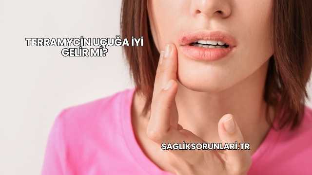 Terramycin Uçuğa İyi Gelir mi?