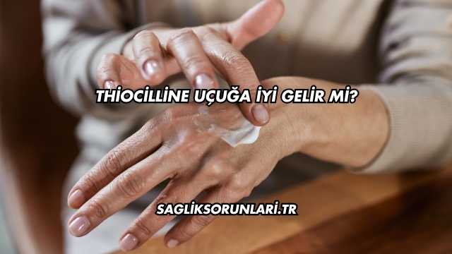 Thiocilline Uçuğa İyi Gelir mi?
