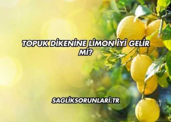 Topuk Dikenine Limon İyi Gelir mi?