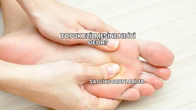 Topuk Ezilmesine Ne İyi Gelir?