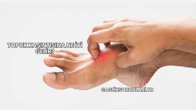 Topuk Kaşıntısına Ne İyi Gelir?