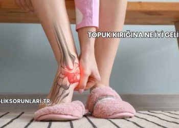 Topuk Kırığına Ne İyi Gelir?