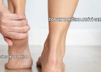 Topuk Yarığına Ne İyi Gelir?