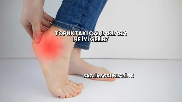 Topuktaki Çatlaklara Ne İyi Gelir?