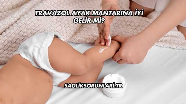 Travazol Ayak Mantarına İyi Gelir mi?