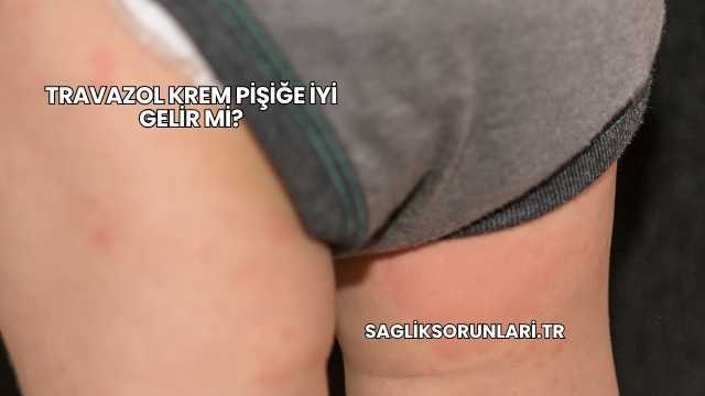 Travazol Krem Pişiğe İyi Gelir mi?