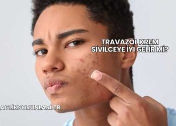 Travazol Krem Sivilceye İyi Gelir mi?
