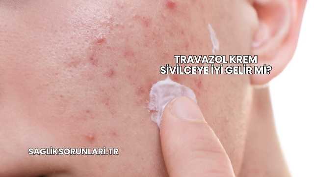 Travazol Krem Sivilceye İyi Gelir mi?