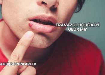Travazol Uçuğa İyi Gelir mi?
