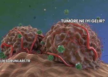 Tümöre Ne İyi Gelir?