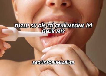 Tuzlu Su Diş Eti Çekilmesine İyi Gelir mi?