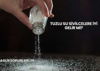 Tuzlu Su Sivilcelere İyi Gelir mi?
