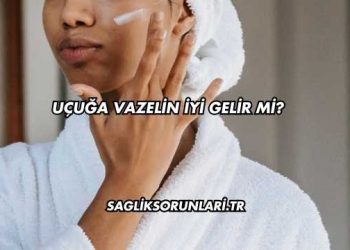 Uçuğa Vazelin İyi Gelir mi?