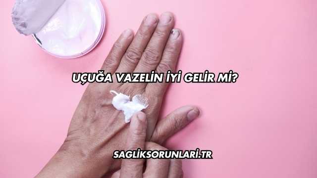 Uçuğa Vazelin İyi Gelir mi?