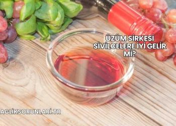 Üzüm Sirkesi Sivilcelere İyi Gelir mi?
