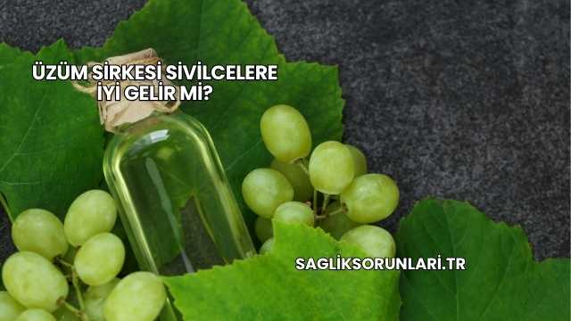 Üzüm Sirkesi Sivilcelere İyi Gelir mi?