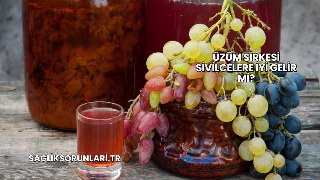 Üzüm Sirkesi Sivilcelere İyi Gelir mi?