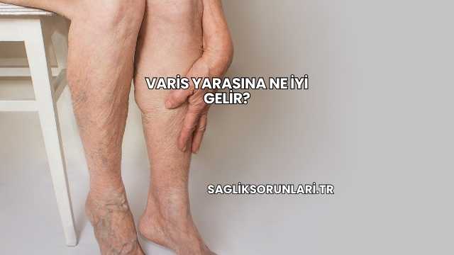 Varis Yarasına Ne İyi Gelir?