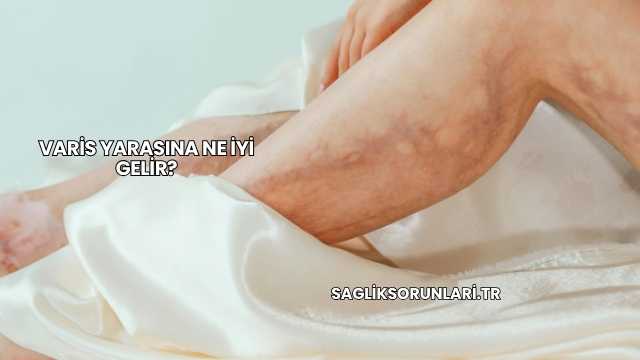 Varis Yarasına Ne İyi Gelir?