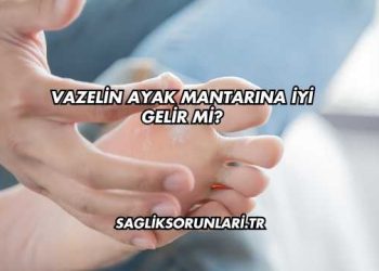 Vazelin Ayak Mantarına İyi Gelir mi?