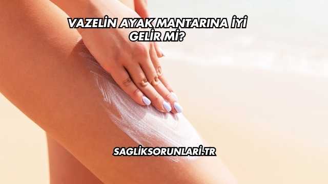Vazelin Ayak Mantarına İyi Gelir mi?