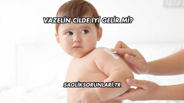 Vazelin Cilde İyi Gelir mi?