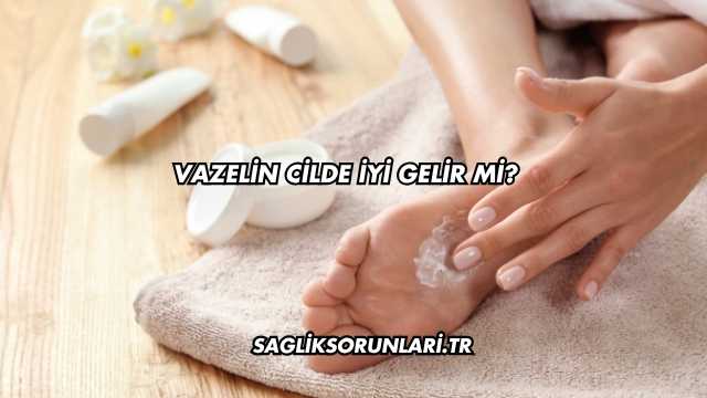 Vazelin Cilde İyi Gelir mi?