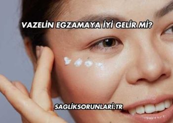 Vazelin Egzamaya İyi Gelir mi?