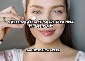 Vazelin Göz Altı Morluklarına İyi Gelir mi?