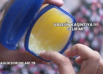 Vazelin Kaşıntıya İyi Gelir mi?