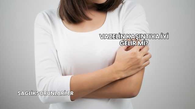 Vazelin Kaşıntıya İyi Gelir mi?