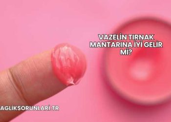 Vazelin Tırnak Mantarına İyi Gelir mi?