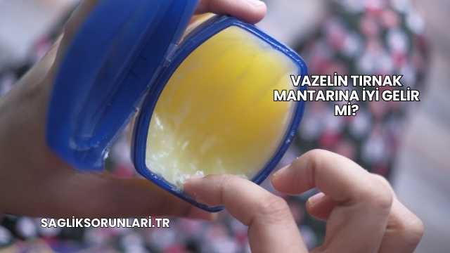 Vazelin Tırnak Mantarına İyi Gelir mi?