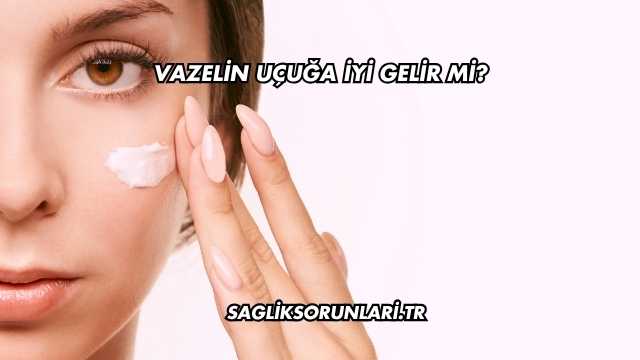 Vazelin Uçuğa İyi Gelir mi?
