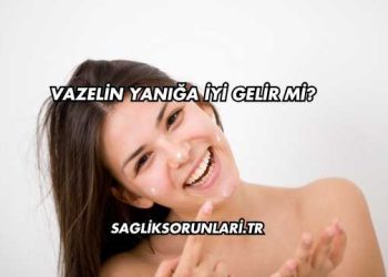 Vazelin Yanığa İyi Gelir mi?