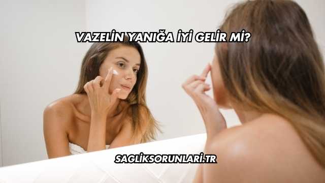 Vazelin Yanığa İyi Gelir mi?