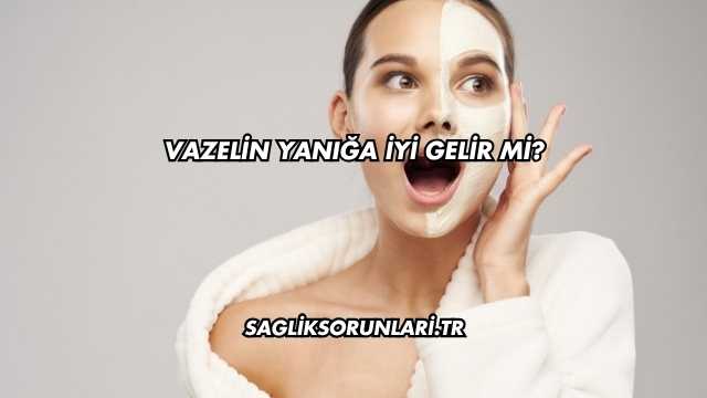 Vazelin Yanığa İyi Gelir mi?