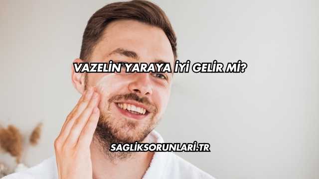 Vazelin Yaraya İyi Gelir mi?