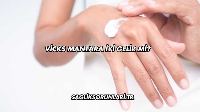 Vicks Mantara İyi Gelir mi?