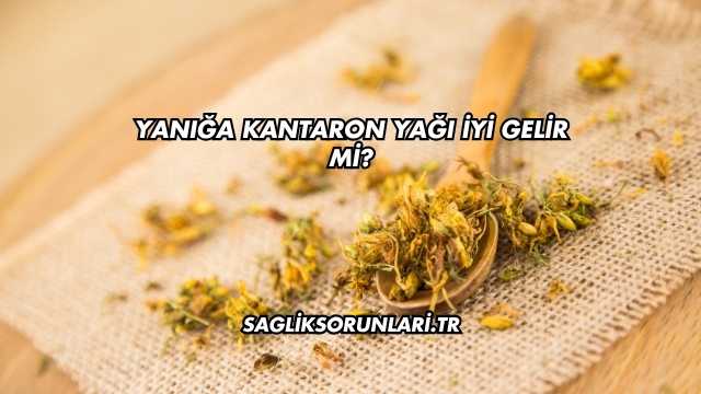 Yanığa Kantaron Yağı İyi Gelir mi?
