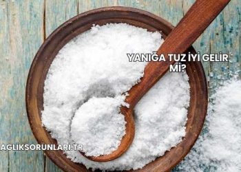 Yanığa Tuz İyi Gelir mi?