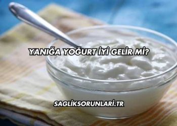 Yanığa Yoğurt İyi Gelir mi?