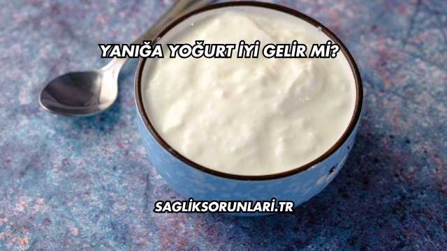 Yanığa Yoğurt İyi Gelir mi?