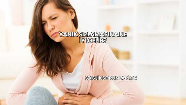 Yanık Sızlamasına Ne İyi Gelir?