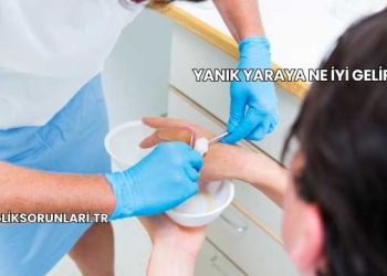 Yanık Yaraya Ne İyi Gelir?