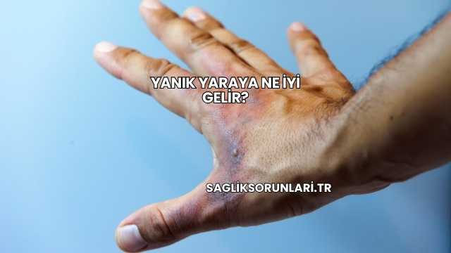 Yanık Yaraya Ne İyi Gelir?