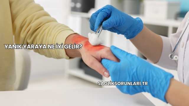 Yanık Yaraya Ne İyi Gelir?