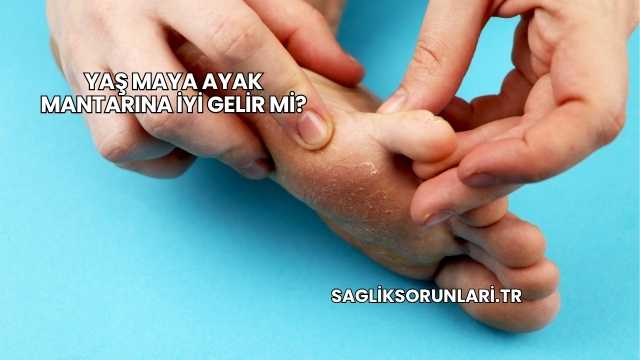 Yaş Maya Ayak Mantarına İyi Gelir mi?
