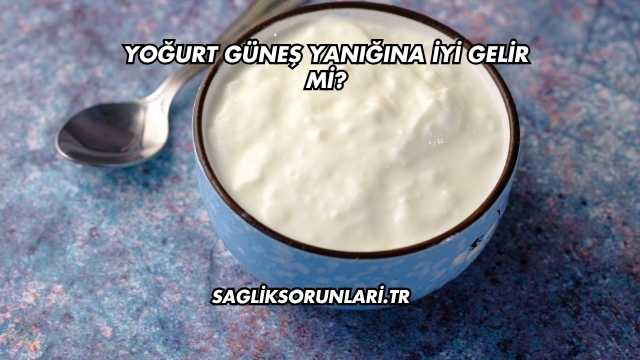 Yoğurt Güneş Yanığına İyi Gelir mi